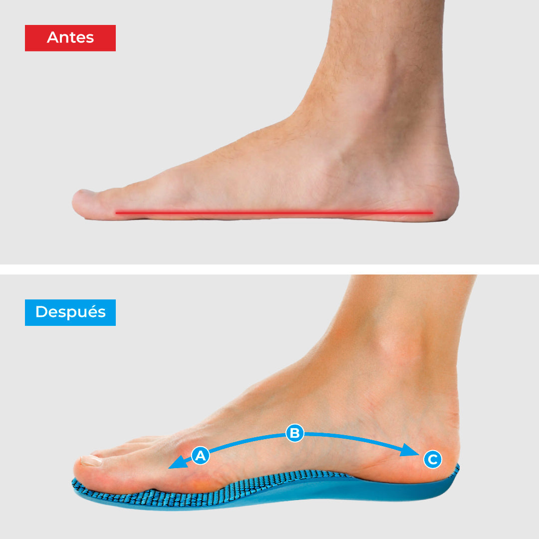 Plantillas ComfyFeet™️  - Disfruta de días sin dolor, sin tratamientos caros ni visitas al médico